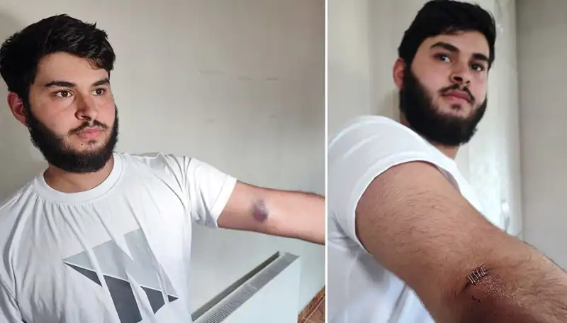 Bahçeye Kaçan Top, Mahallede Şenlik Atmosferi Yarattı!
